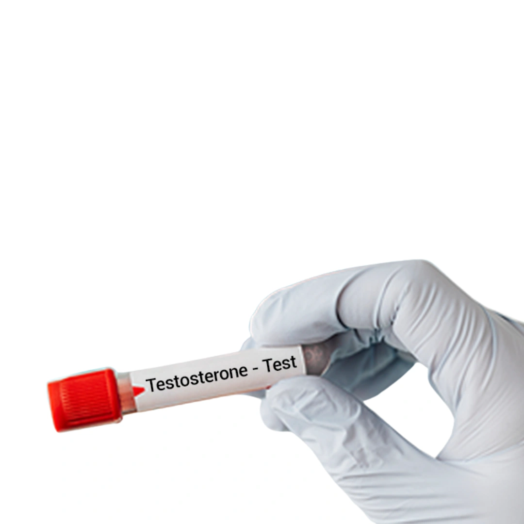 TESTOSTERONE TOTAL (2ND GENERATION), SERUM