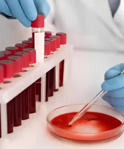 CMV VIRAL LOAD DETECTION TEST