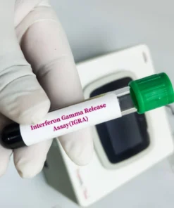 TB - FERON , INTERFERON GAMMA RELEASE ASSAY, BLOOD