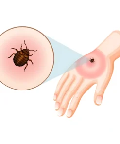 Scrub Typhus Igm Antibody