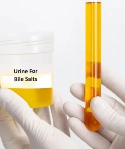 URINE BILE SALTS AND PIGMENTS