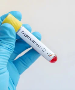 CRYPTOCOCCUS ANTIGEN DETECTION CSF