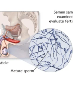 Semen Analysis.