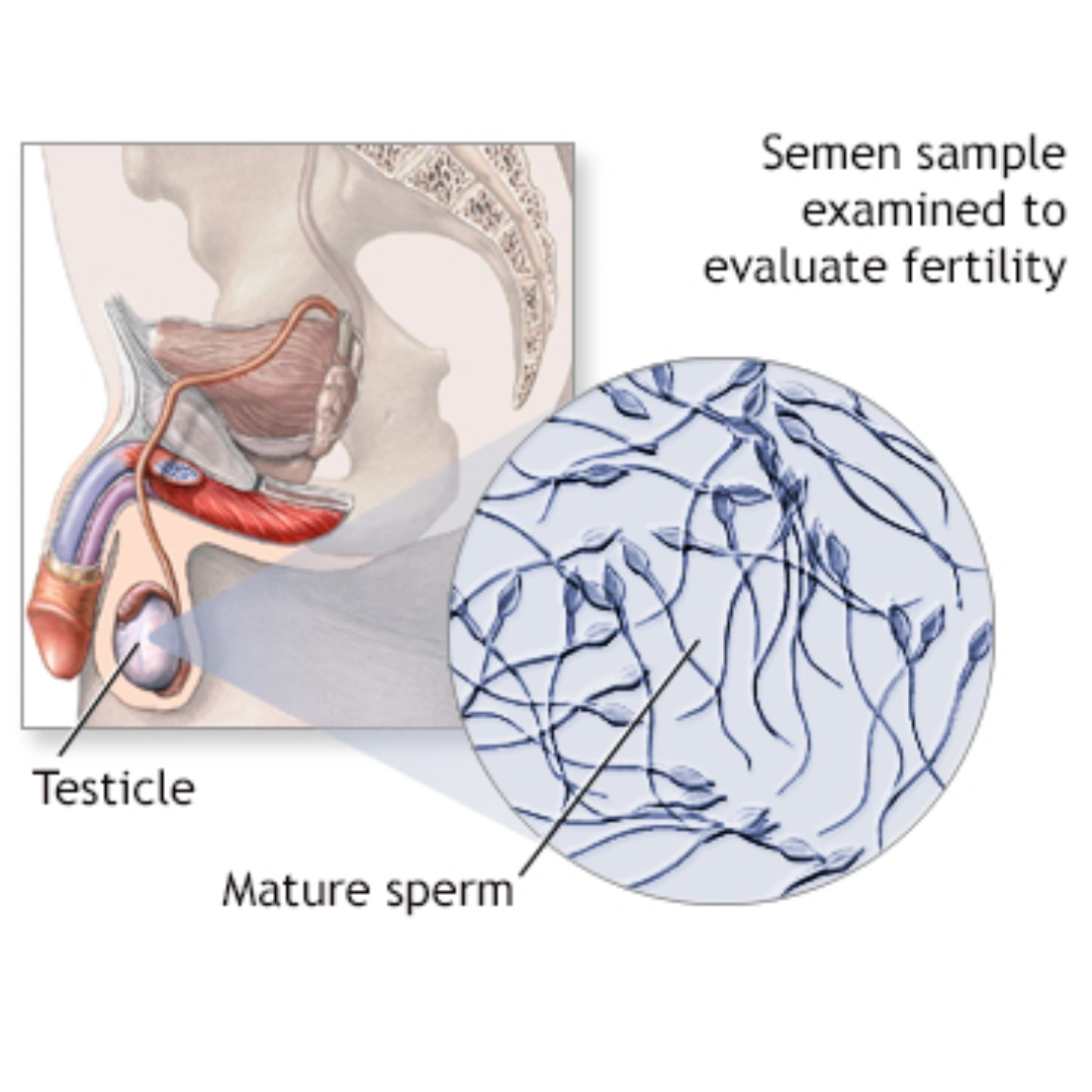 Semen Analysis.