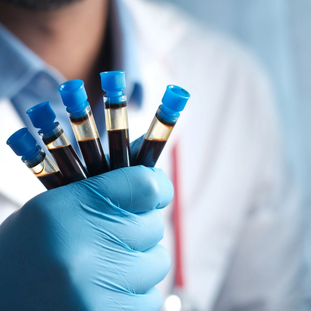 VITAMIN B6 (PYRIDOXAL PHOSPHATE)