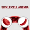 Sickle Cell Dna Pcr Pnd