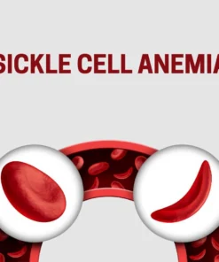 Sickle Cell Dna Pcr Pnd