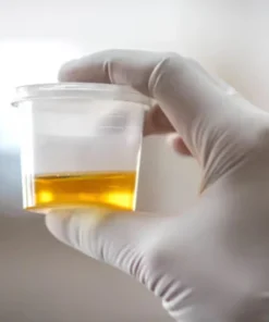 CALCIUM, 24 HRS URINE