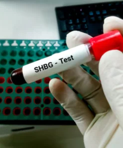 Sex Hormone Binding Globulin(Shbg),Serum