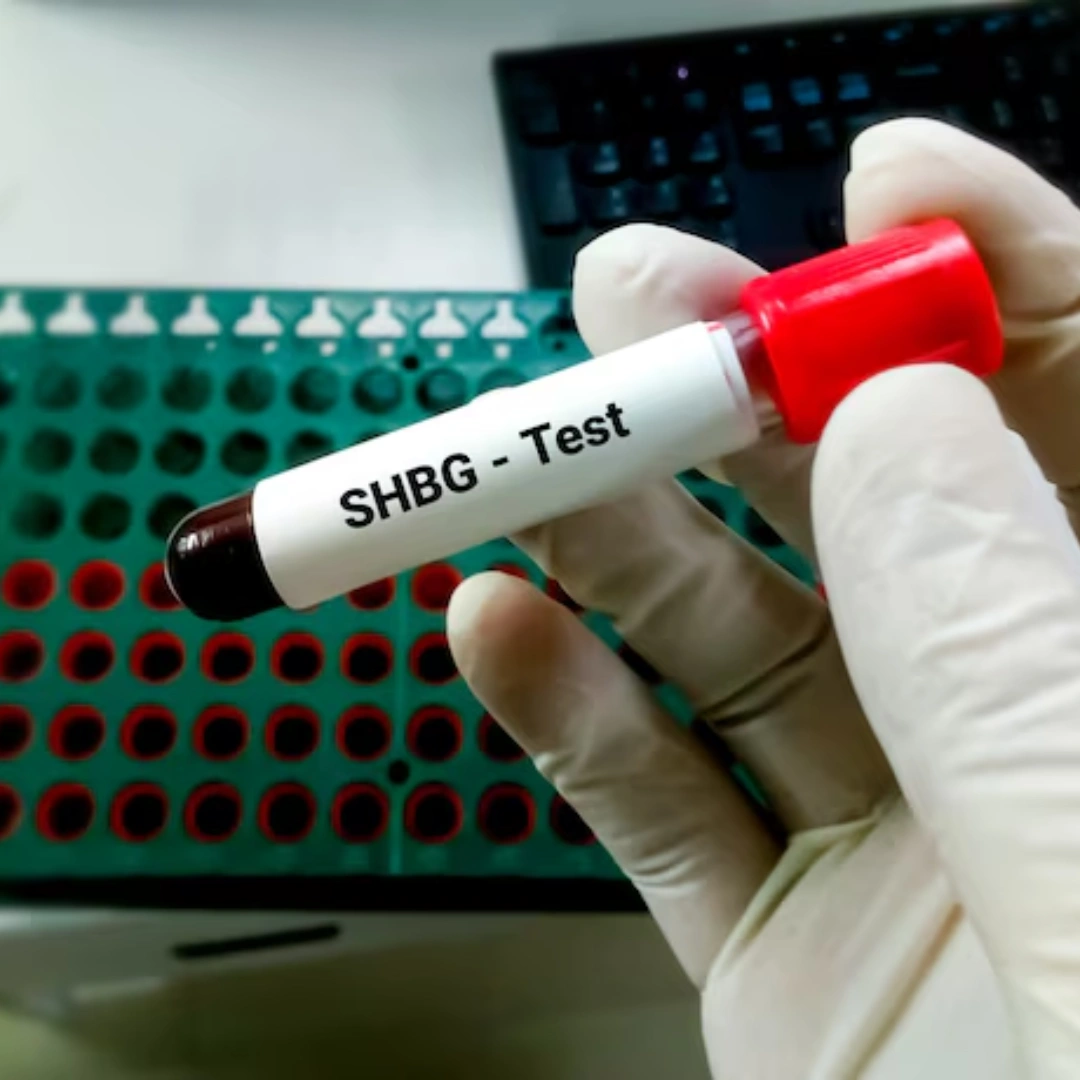 Sex Hormone Binding Globulin(Shbg),Serum