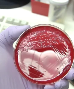 CULTURE AEROBIC & SUSCEPTIBILITY, SPUTUM