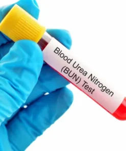UREA, SERUM