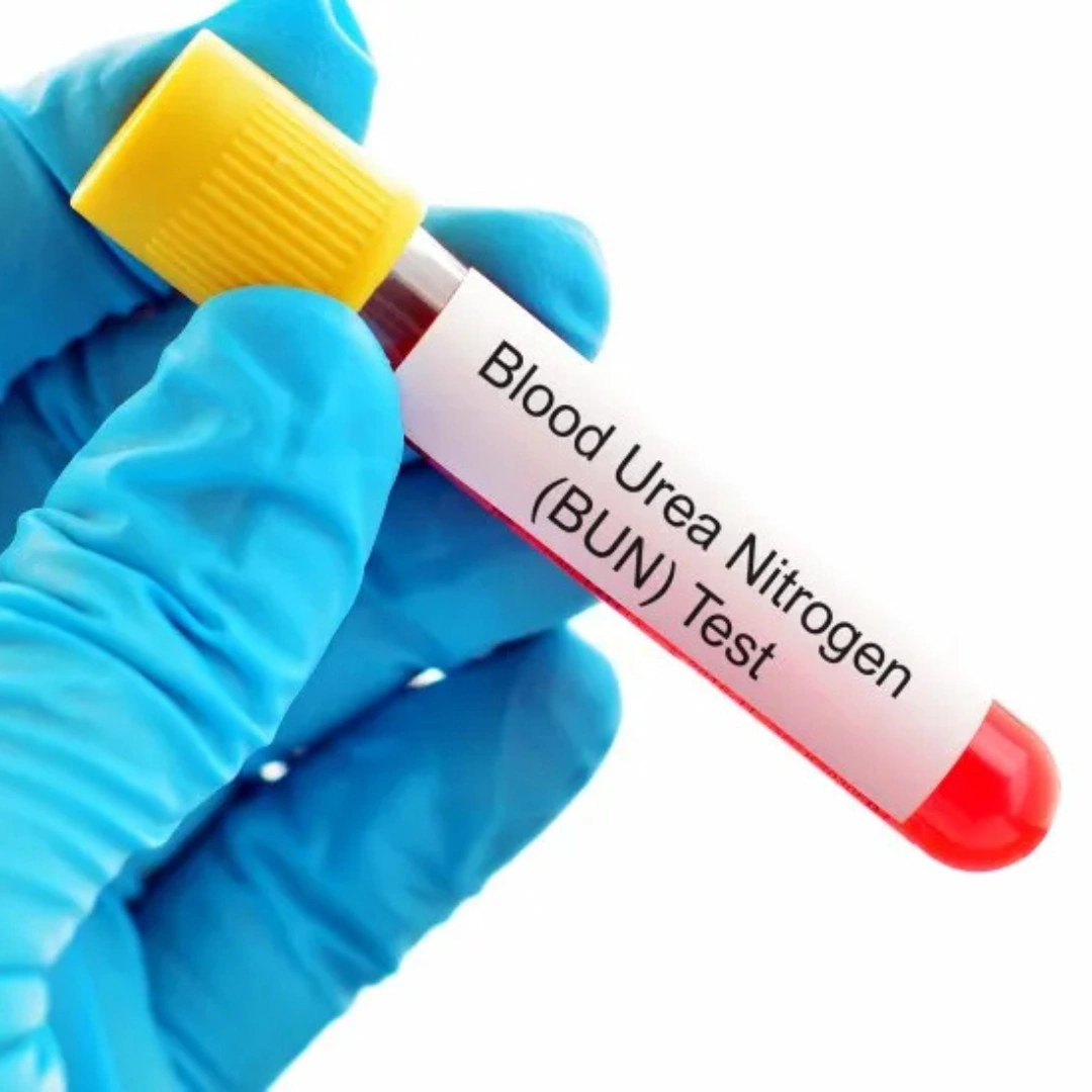 UREA, SERUM