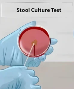 CULTURE, AEROBIC & SUSCEPTIBILITY, STOOL