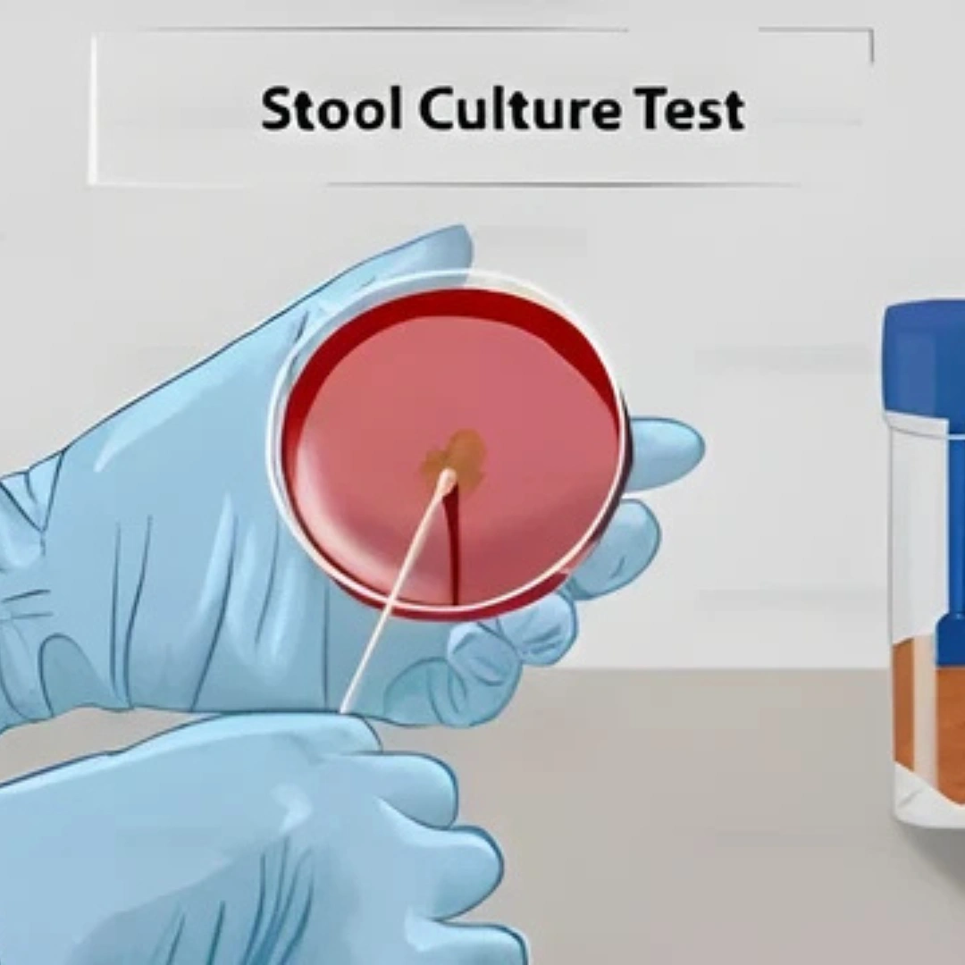 CULTURE, AEROBIC & SUSCEPTIBILITY, STOOL