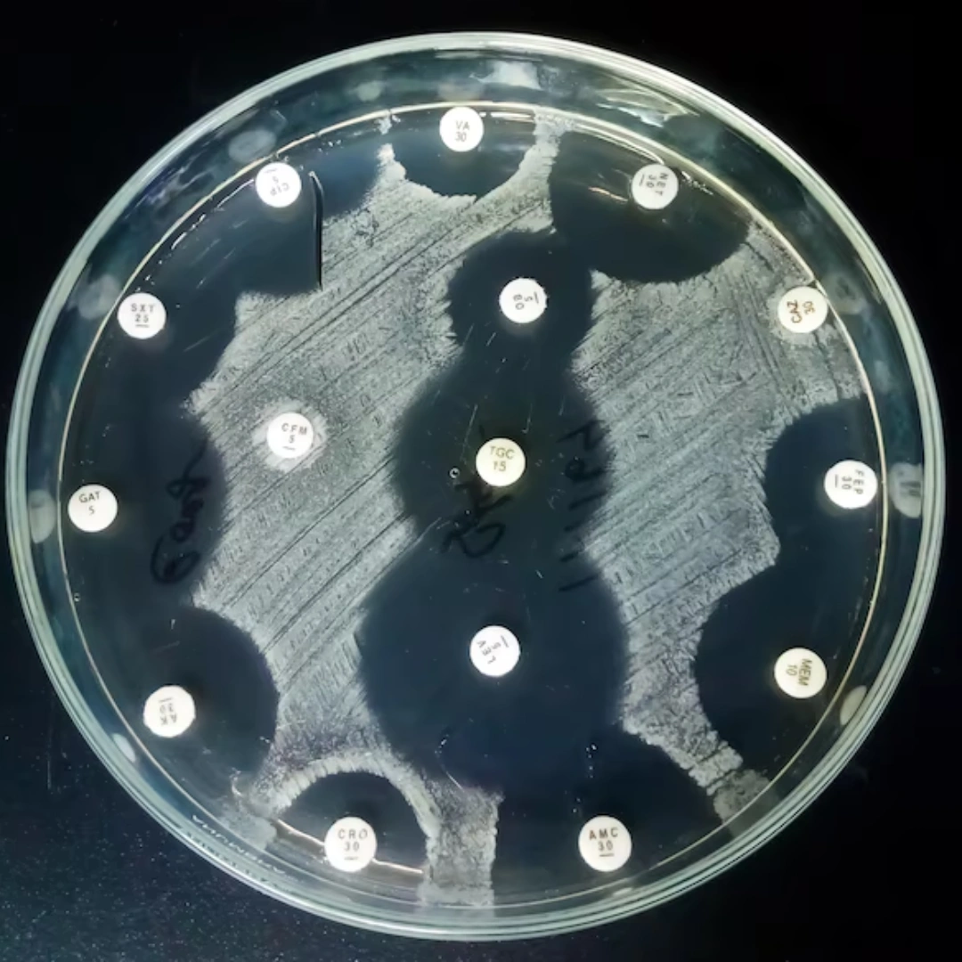 CULTURE, AEROBIC & SUSCE- PTIBILITY, MISCELLANEOUS