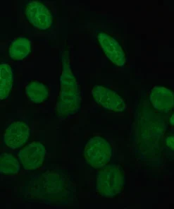 Sjogren's Antibody (Ss-A) / (Anti-Ro)