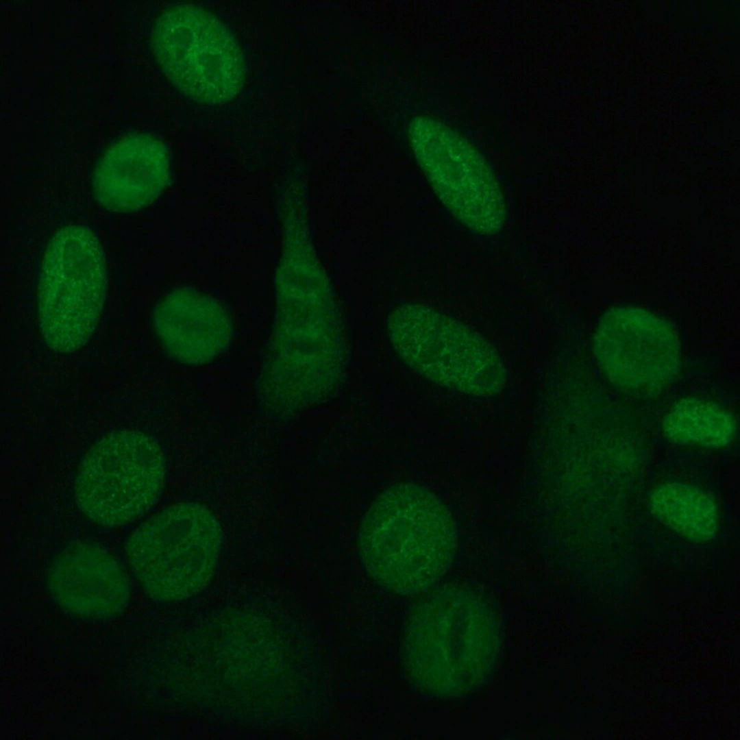Sjogren's Antibody (Ss-A) / (Anti-Ro)