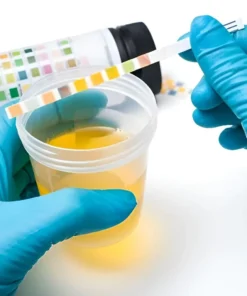 ALUMINIUM,  SPOT URINE