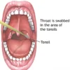 CULTURE, AEROBIC & SUSCE- PTIBILITY,THROAT SWAB