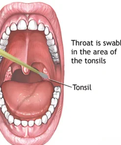 CULTURE, AEROBIC & SUSCE- PTIBILITY,THROAT SWAB