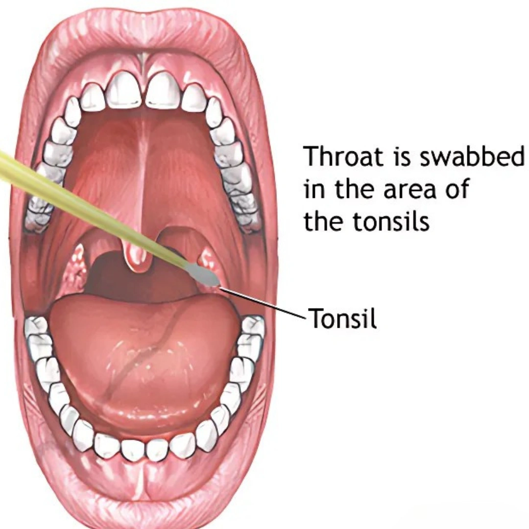 CULTURE, AEROBIC & SUSCE- PTIBILITY,THROAT SWAB