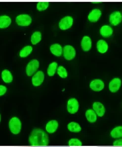 Sjogren's Antibody (Ss-B) / (Anti-La)