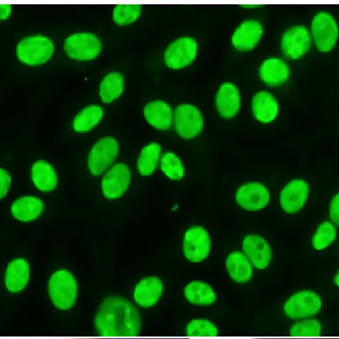Sjogren's Antibody (Ss-B) / (Anti-La)