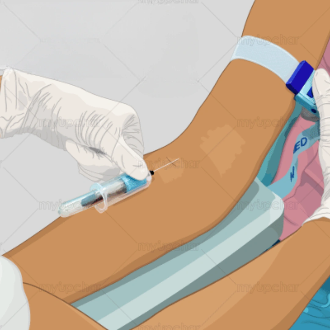 Sm Antibody Smith Antibody Serum