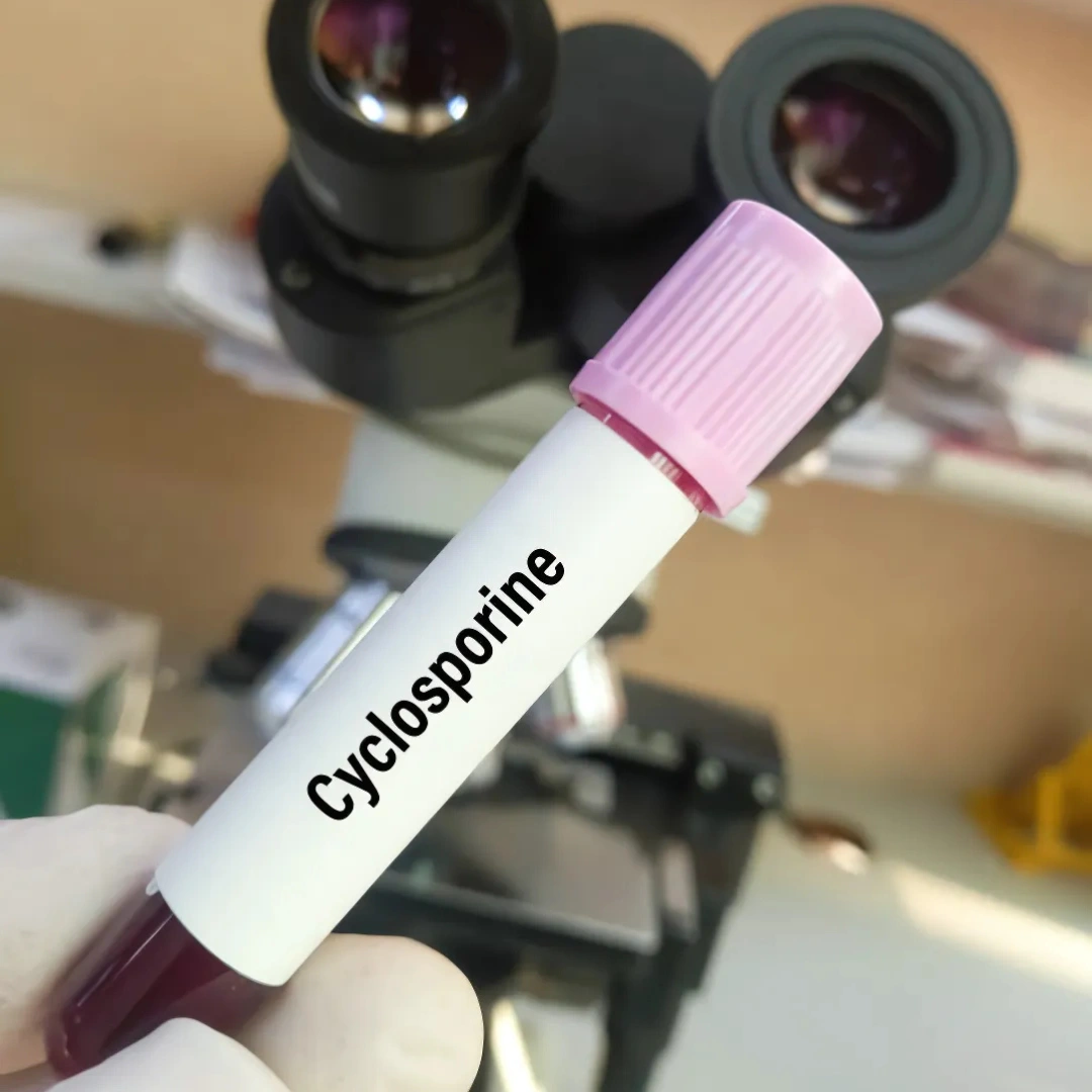 CYCLOSPORINE, BLOOD