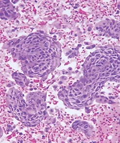 Slide / Block Issue Up to 3