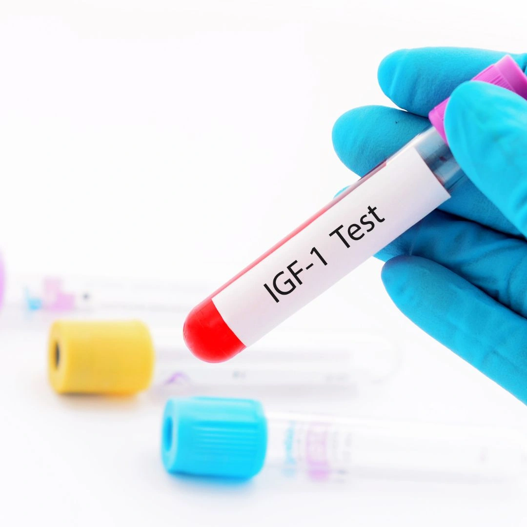INSULIN LIKE GROWTH FACTOR (IGF-I) - SOMATOMEDIN -C