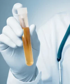 Sodium, 24 Hrs Urine