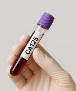 TSH RECEPTOR ANTIBODIES LATS, TSI