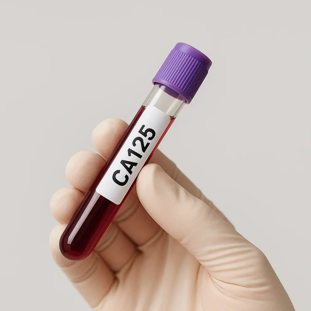 TSH RECEPTOR ANTIBODIES LATS, TSI