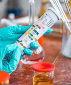 Sodium, Random Urine