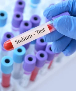 Sodium, Serum