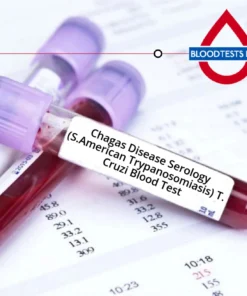 TRYPANOSOMA CRUZI ANTIBODY, SERUM