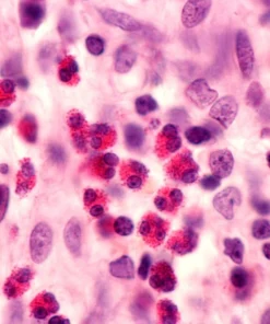 Sputum For Eosinophil