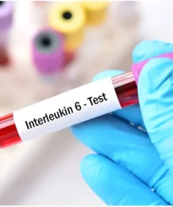 INSULIN RESISTANCE (HOMA-IR)