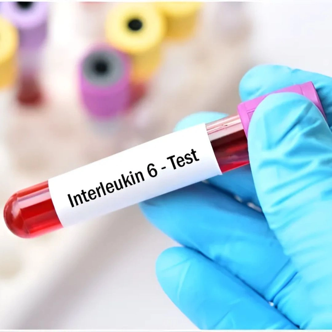 INSULIN RESISTANCE (HOMA-IR)