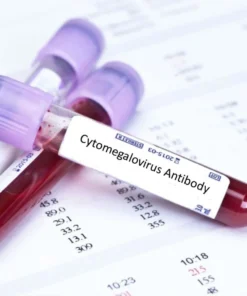 CYTOMEGALOVIRUS IGM, SERUM
