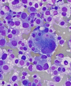 CYTOPATH SECOND OPINION