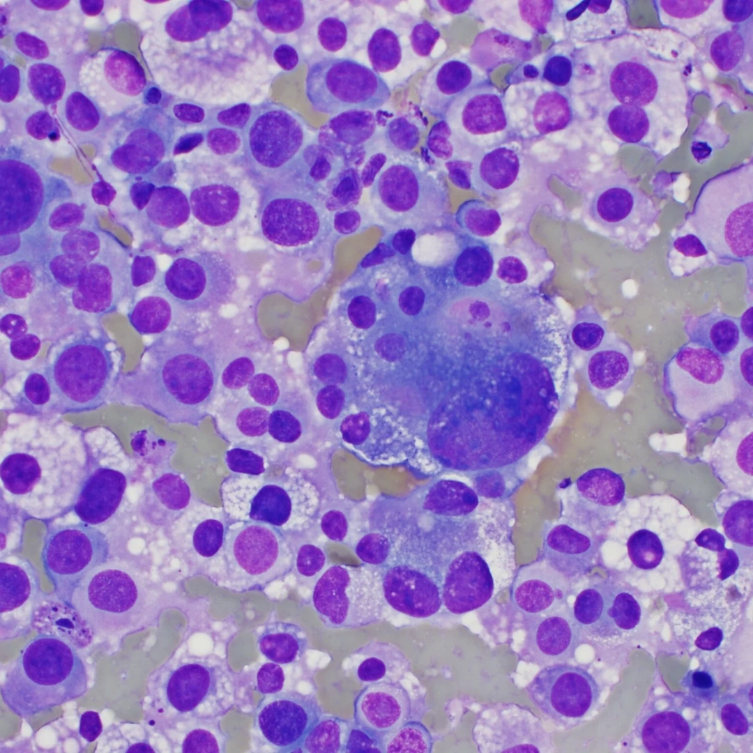 CYTOPATH SECOND OPINION