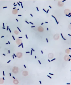 Stool For Clostridium Difficile