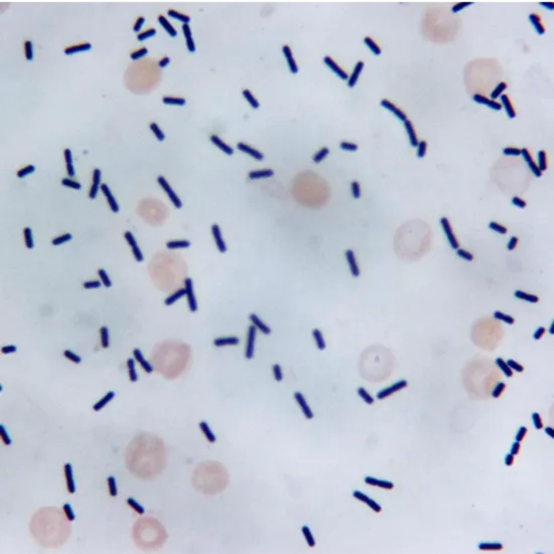Stool For Clostridium Difficile