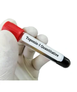 TROPONIN I [QUANTITATIVE]