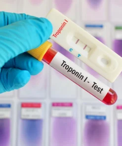 TROPONIN I