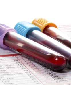 COMPLEMENT C4, SERUM