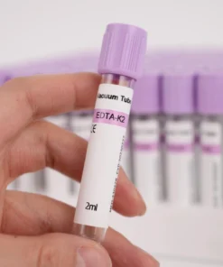 VIT A, SERUM\EDTA PLASMA